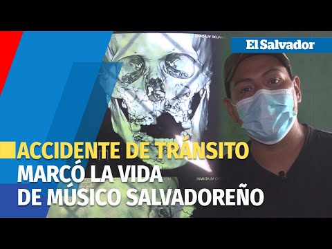 La inquebrantable voluntad de Osvaldo, el músico salvadoreño marcado por un accidente de tránsito