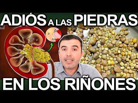 DESTRUYE LAS PIEDRAS EN TUS RIÑONES - Como Eliminar Las Piedras O Calculos Renales