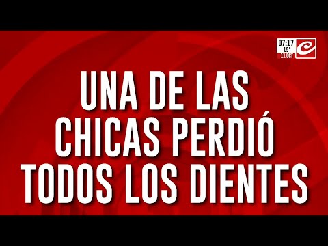 Jóvenes chocaron contra el Metrobús de Palermo: una de las chicas perdió todos los dientes