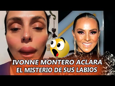 Ivonne Montero aclara el MISTERIO de su repentina INFLAMACIÓN labial y tranquiliza a sus fans