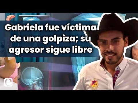 Gabriela fue golpeada al salir de un karaoke; el presunto agresor sigue libre