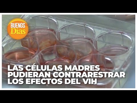 Las células madres pudieran contrarrestrar los efectos del VIH - María E. Landaeta