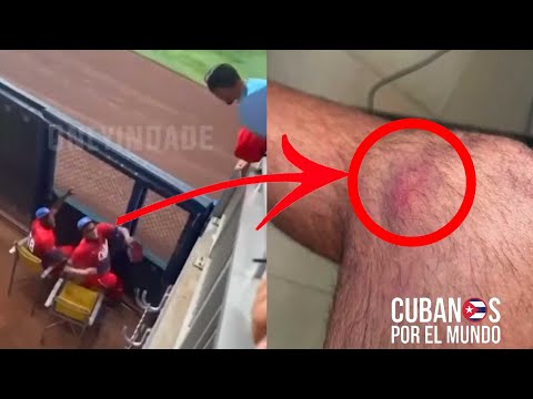 Aficionado de Miami muestra lecciones provocadas por el acto violento del pitcher del equipo Cuba