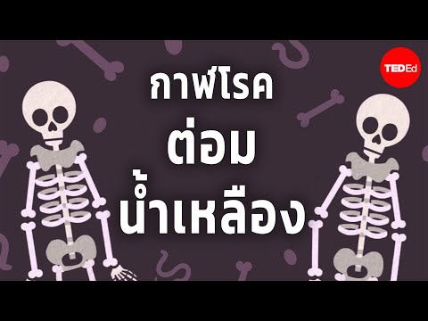 อดีตปัจจุบันและอนาคตของกาฬโร