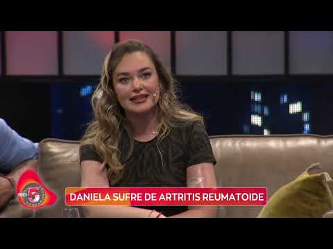 Daniela Nicolás se sinceró sobre la difícil enfermedad con la que vive. TBT, Canal 13.