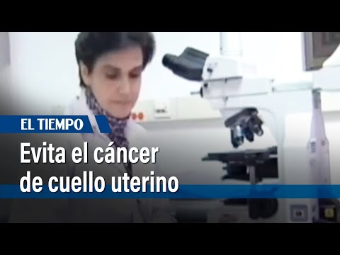 La prueba ADN VPH es gratuita en Colombia | El Tiempo