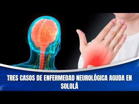 Tres casos de enfermedad neurológica aguda en Sololá