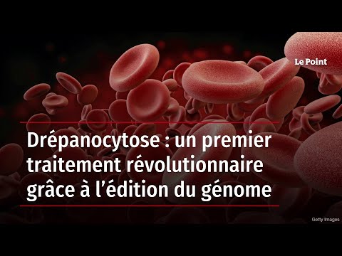 Drépanocytose : un premier traitement révolutionnaire grâce à l’édition du génome