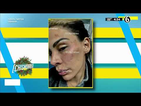 ¡Video de Stephanie Valenzuela con agresiones falsas! | El Chismorreo