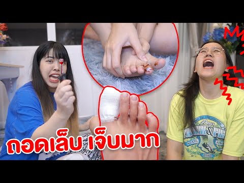 นิ้วแตก-ต้องถอดเล็บ-เจ็บมาก-|- นิ้วแตก-ต้องถอดเล็บ-เจ็บมาก-|-