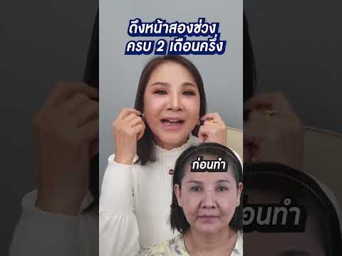 คนมีร่องแก้มเยอะต้องดูคลิปนี้