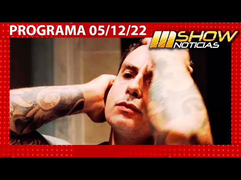 MSHOW - Programa del 05/12/22 - Fede Bal mostró su brazo tras su accidente en Brasil