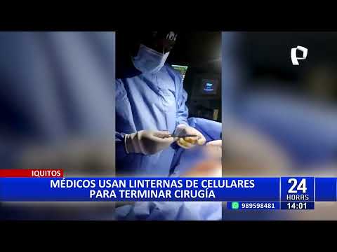Iquitos: Médicos concluyen cirugía con linternas de celular por apagón eléctrico