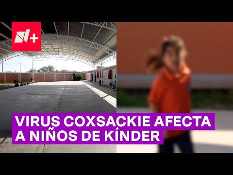 Madres temen que virus coxsackie se esté propagando en kínder - N+