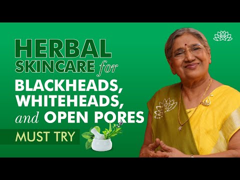 How To Get Rid of Blackheads, Whiteheads, and Open Pores Naturally | Natural Skincare Remedies