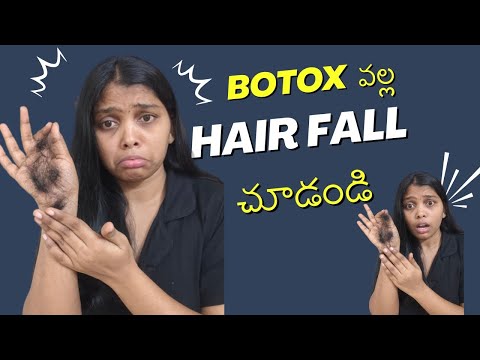 Botox  చేయించుకోడం వల్ల hair fall చూడండి😭😭.. 