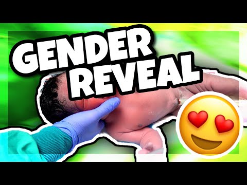 We finally found out the baby's gender afterbirth... is it a BOY or GIRL ?