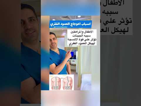 أسباب إعوجاج العمود الفقري او الجنف