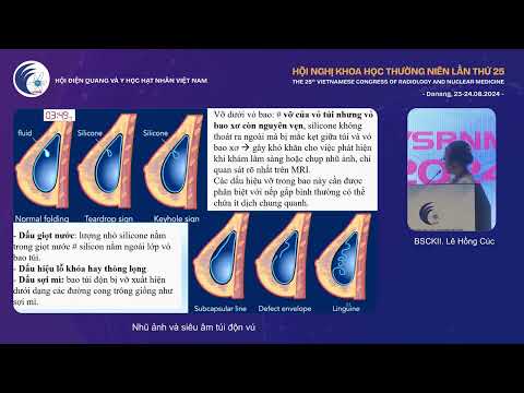 4. Nhũ ảnh và siêu âm túi độn vú (BS.CKII. Lê Hồng Cúc)