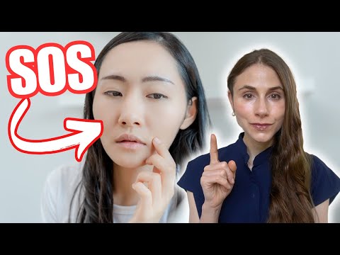 Summer Skin Woes: Distinguishing Heat Rash from Acne