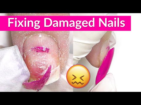 Damaged Nails Transformation w/ Apres Gel X