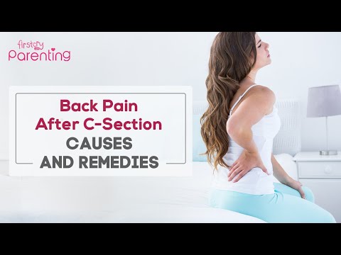 Back Pain After C Section - Reasons and Remedies