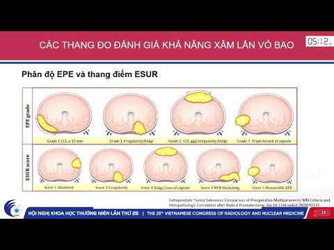 7. Đánh giá các thang đo xâm lấn vỏ bao của ung thư tuyến tiền liệt trên CHT (BSNT. Ngô Thúy Nga)