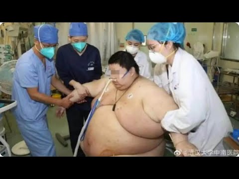 Hombre de 26 años aumento 102 kilos durante la cuarentena