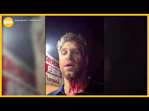 '<strong>Pretty</strong> <strong>Little</strong> <strong>Liars</strong>' actor beaten and robbed in West Hollywood