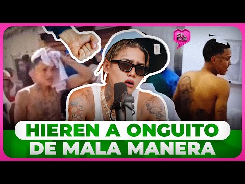 ¡VIVO PARA CONTARLO! HIEREN A ONGUITO WA DE MALA MANERA EN LA 42