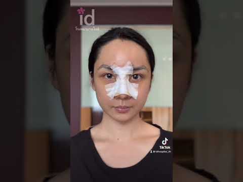รีวิวศัลยกรรม-หน้าตาที่เปลี่ยน รีวิวศัลยกรรม-หน้าตาที่เปลี่ยน