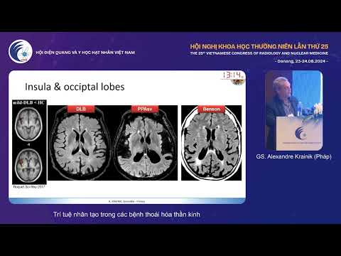 2. Trí tuệ nhân tạo trong các bệnh thoái hóa thần kinh (GS. Alexandre Krainik)