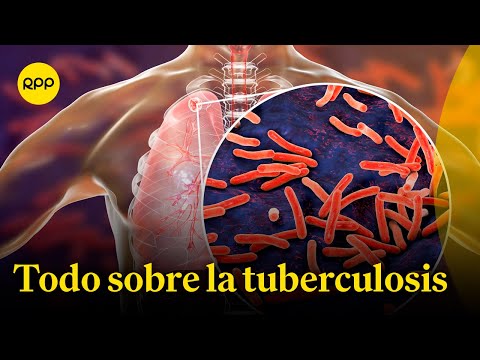 Tuberculosis: ¿Cuál es la diferencia entre ser portador y estar enfermo?