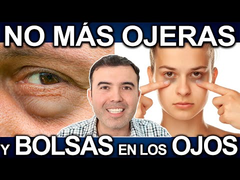 2025 SIN BOLSAS EN LOS OJOS - Como Eliminar Las Ojeras Y Ojos Hinchados