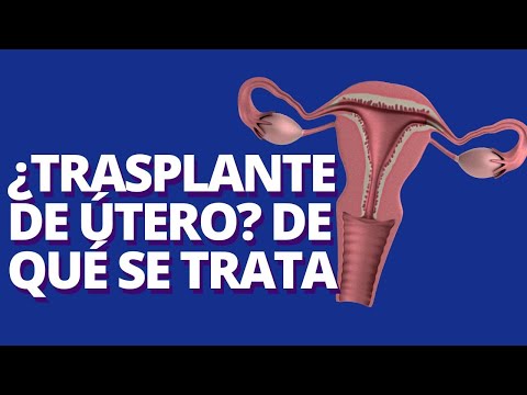 Trasplante de útero: opción para mujeres que no pueden concebir