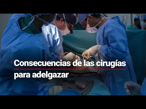 Cirugia bariátrica para adelgazar: ¿cuáles son sus beneficios y consecuencias médicas?