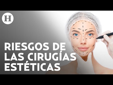 ¡Piensa dos veces antes de someterte a una cirugía estética! Doctor explica sus implicaciones