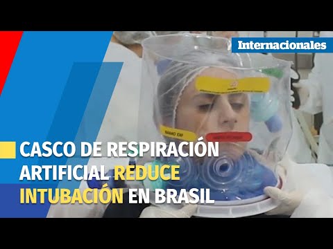 Un casco de respiración artificial reduce intubación en un 60 % en Brasil
