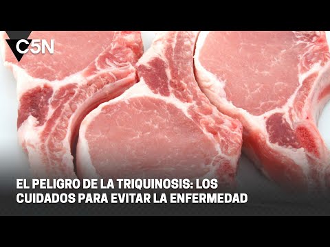 Los CUIDADOS para EVITAR la TRIQUINOSIS