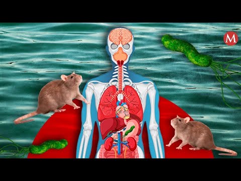 ¿Qué tan peligrosa es la leptospirosis?