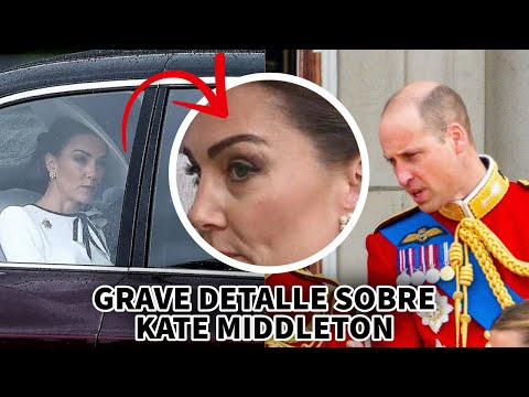 GRAVE DETALLE en Reaparición de Kate Middleton: Polémicas Especulaciones y Análisis
