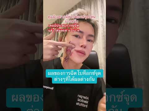 จุดฉีดโบท็อกซ์ที่ส่งผลต่างกัน