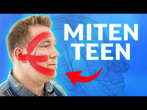 Kolmoishermon kipu? Näin teen teippauksen helpottamaan oireita