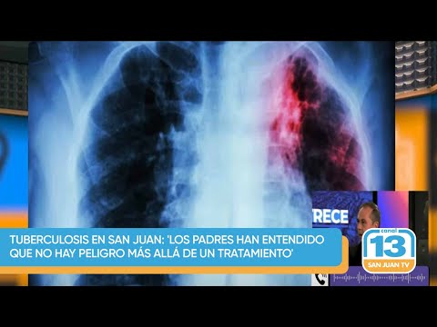 tuberculosis en San Juan: 'Los padres han entendido que no hay peligro más allá de un tratamiento'