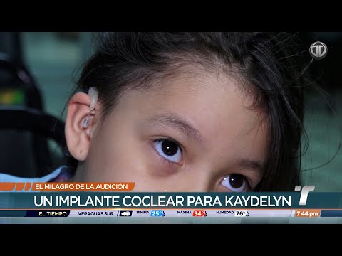 El milagro de la audición, un implante coclear para Kaydelyn