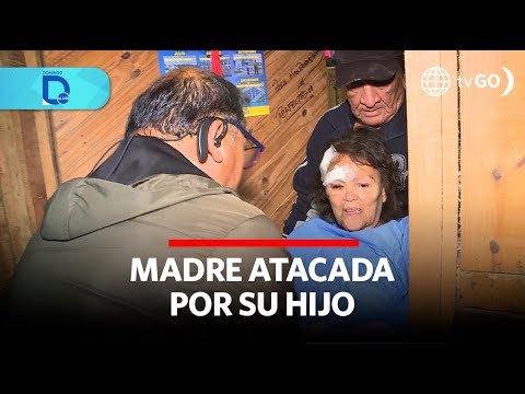 Madre atacada por su hijo | Domingo al Día | Perú