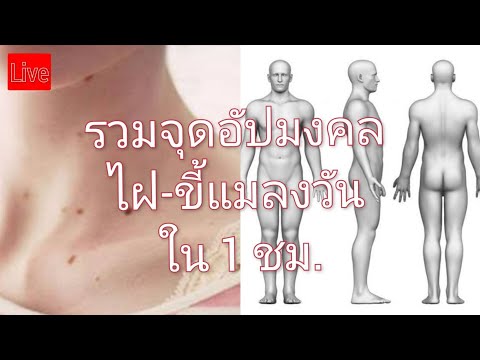 รวมจุดอัปมงคล-ไฝ-ขี้แมลงวัน-ภา รวมจุดอัปมงคล-ไฝ-ขี้แมลงวัน-ภา