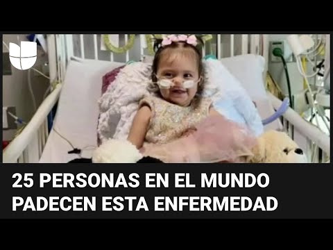 Estamos orando por un milagro: bebé hispana padece una rara enfermedad que no tiene tratamiento