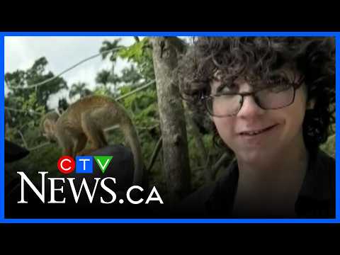 Edmonton teen loses part of skull on vacation in Dominican Republic