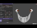 Exocad     Articulator